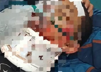 Keadilan untuk Arga: Pelajar SMK Kritis Diduga Dianiaya Oknum Polisi Polda Banten